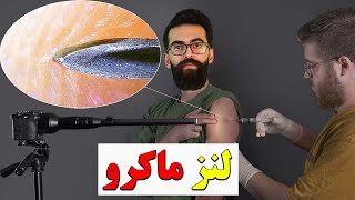 از لحظه فرو کردن سوزن آمپول تا کپک نان سالم با لنز اولترا ماکرو.انواع لنز دوربین