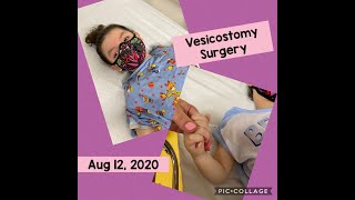 Vesicostomy Surgery