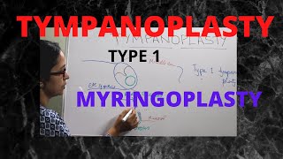 064. Tympanoplasty: Part 3 (Type 1 Tympanoplasty)  #hearingimpaired