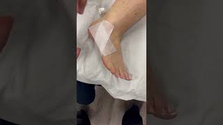 CalcanealCuboidJoint - 5th MTP taping