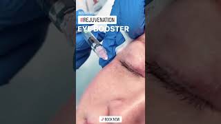 Botox Eye Booster for Rejuvenation at EDEN AESTHETICS Dubai | Anti-Aging & Fine Line Reduction