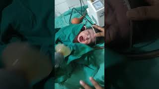 Performing Resuscitation New born #neonate #gynaecologists #fyp #shorts #trend #doctor #babygirl