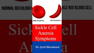 Sickle cell anemia symptoms #shorts #ytshorts