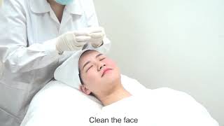 Microneedle RF Treatment Video