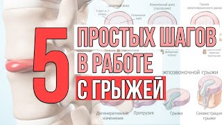 5 простых шагов в работе с грыжей и остеохондрозом позвоночника.