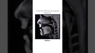 A real-time MRI scan of a person speaking | #shorts #shortvideo #science #mri #doctor #neet #neetug