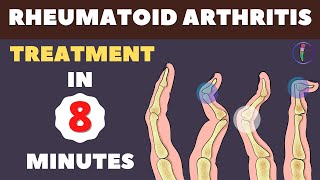 Rheumatoid Arthritis Treatment - New Medicines and Updates