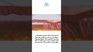 اسکارآکنه داری؟