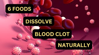 Best foods recipe to Dissolve Blood Clots in body