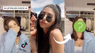 The best of TikTok's lip filler check