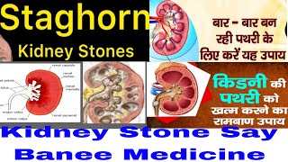 Staghorn Kidney Stone Kya Hota Hai?Repeated Formation OF Kidney Stone Medicine/Stone Say Banee Dava.