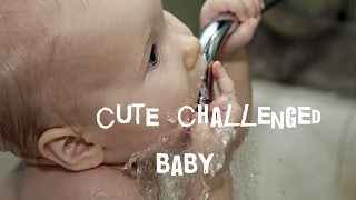 cute challenged baby