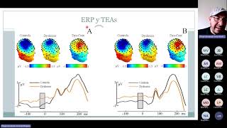 Potenciales postsinápticos: el lenguaje de las neuronas