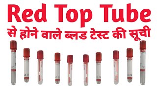 Blood Test List perform in Red top tube