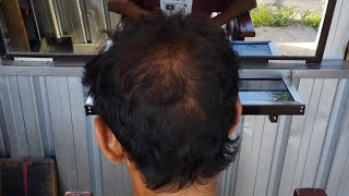 parah banget RAMBUT TIPIS mau di buatin model mohak bagian tengah nya udah botak