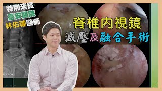 健康新知2024 - 脊椎內視鏡減壓及融合手術