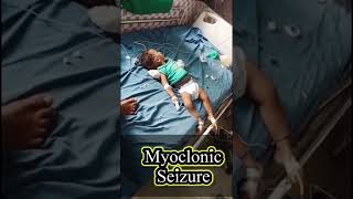 Myoclonic seizure|#Medical posting#MBBS #medical #Neet short motivational Video#motivation#Neet 2022