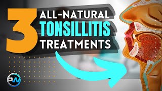 Tonsillitis Cure: Quickly Treat The Symptoms & Prevent The Causes Of A Swollen Sore Throat