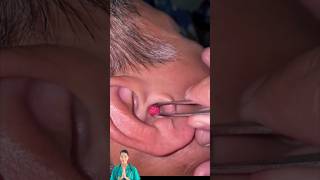 Dr.Natacha, satisfying earwax removal.