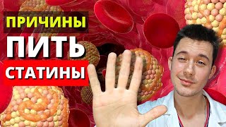 Статины | Показания к применению | Когда нужно пить статины