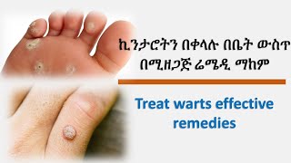 ኪንታሮትን በቀላሉ ማከም /Treat warts effective remedies