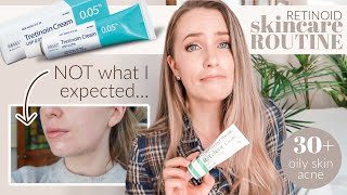 I tried a Retinoid for 3 MONTHS / Results, Side Effects, & Skincare Routine 30+ Oily Skin Acne-Prone