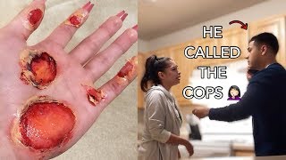 BURN PRANK (HE CALLED THE COPS)