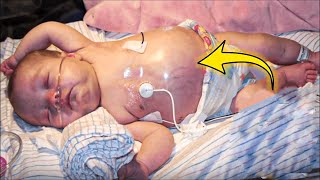 TWIN BABIES' bellies begin to SWELL, then doctors DISCOVER THIS!