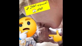 شاهد اغرب 10 اطفال في العالم