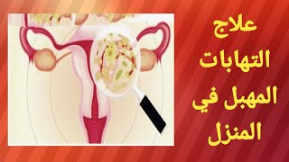 علاج التهابات المهبل في المنزل/معلقه واحده وانسي التهابات وافرازات المهبل