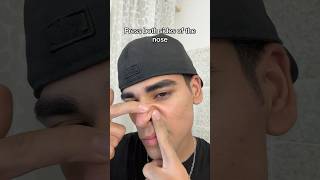 Glow up tips for men! #glowup #tips #men #blackhead #nose #fyp #viral