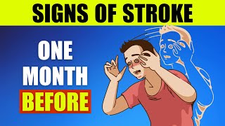 STROKE WARNING! Top 9 Signs One Month Before - Don't Ignore