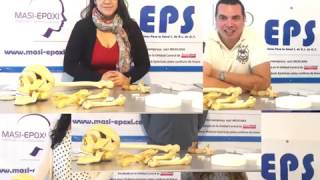 Programa de apoyo para el desarrollo de material de craneoplastia.