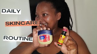 Remove your Dark Spots  With Vaseline and Harmansis|Skin care |Personal Experience |Sinazo Palaza