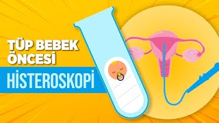 Tüp Bebek Tedavisi Öncesi Histeroskopi Yapılmalı Mı? Hangi Durumlarda Histeroskopi Uygulanır?