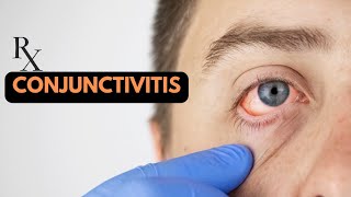 Conjunctivitis | Homoeopathic Treatment