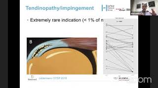 Recent Advances in Rotator Cuff Management