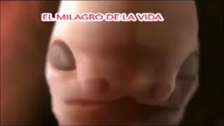 NO AL ABORTO EL MILAGRO DE LA VIDA