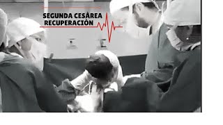 SEGUNDA CESÁREA CÓMO ES LA RECUPERACIÓN? /mi experiencia./