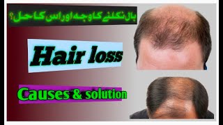 male pattern baldness