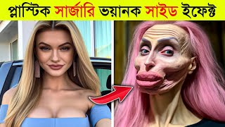 বেশি সুন্দর হতে গেলে যা হয় ll Top 10 Celebrity Before and After Plastic Surgery