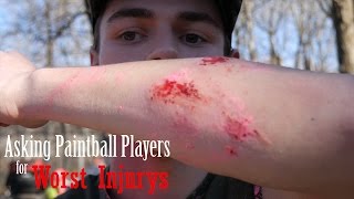 Paintball Worst Injuries ➤ Asking Paintball Players EP. 1