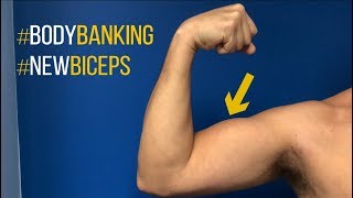 Bicep Augmentation With Body Banking with Dr. Steinbrech NYC and LA Plastic Surgeon