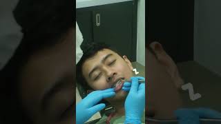 Gigitan Bikin Gregetan | New Look Dental Care 087770139191