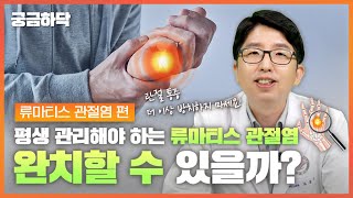 평생 관리해야 하는 류마티스 관절염, 🔎 완치할 수 있을까? 🤷‍♀️ 류마티스 관절염 편│궁금하닥