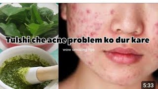 तुलसी के पत्ते इस्तेमाल che फ़ायदे |clear skin and healthy healt#tulsi #natural #solankidivya69