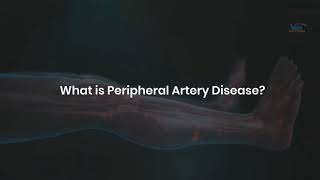 What is Peripheral Artery Disease? | How to prevent Peripheral Artery Disease