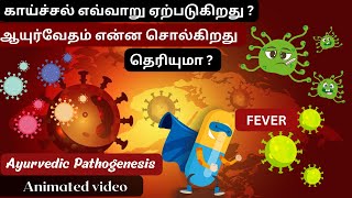 காய்ச்சல் எவ்வாறு ஏற்படுகிறது ? Fever in Ayurveda |Fever Pathogenesis |Jwara Samprapti |