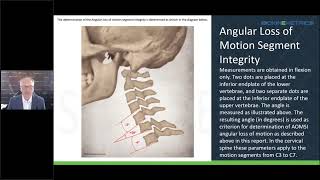 How to Provide an Impairment Rating in 15 Minutes Using X Ray Software & ​​​​​​​No X Ray Machine