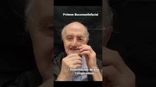 Dr Heitor Ribeiro Birnfeld faz um trabalho fantástico em reabilitar Vidas, prótese Bucomaxilofacial.